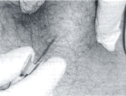 Figura 3